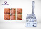 Vaginal Tightening Co2 Fractional Laser Machine Scar Removal 33.3hz Frequency